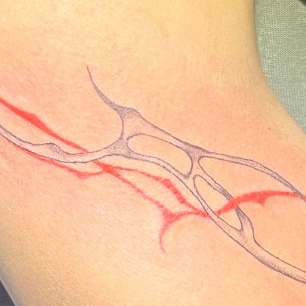 FL-01 blade — healed on skin