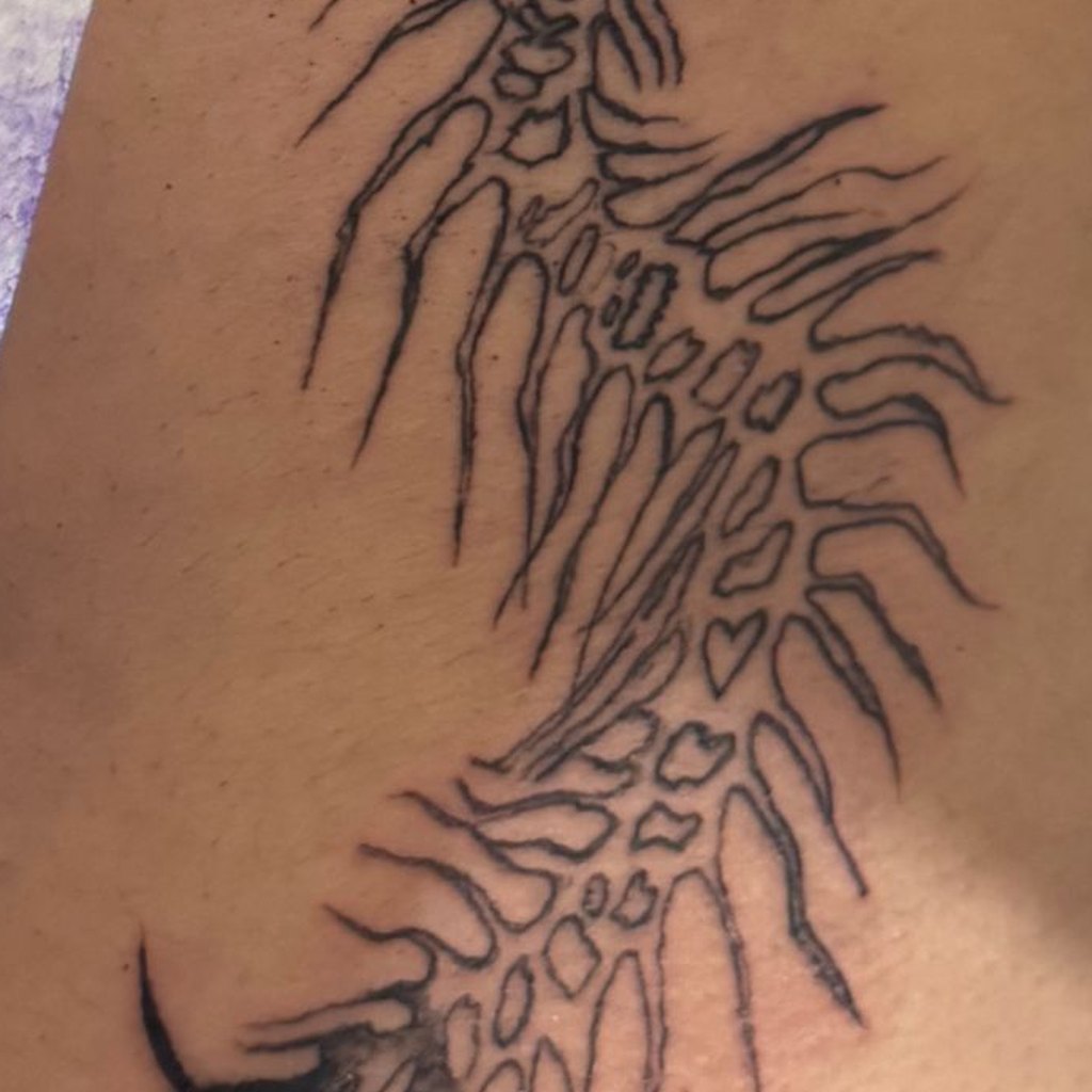 FL-07 spine — healed on skin
