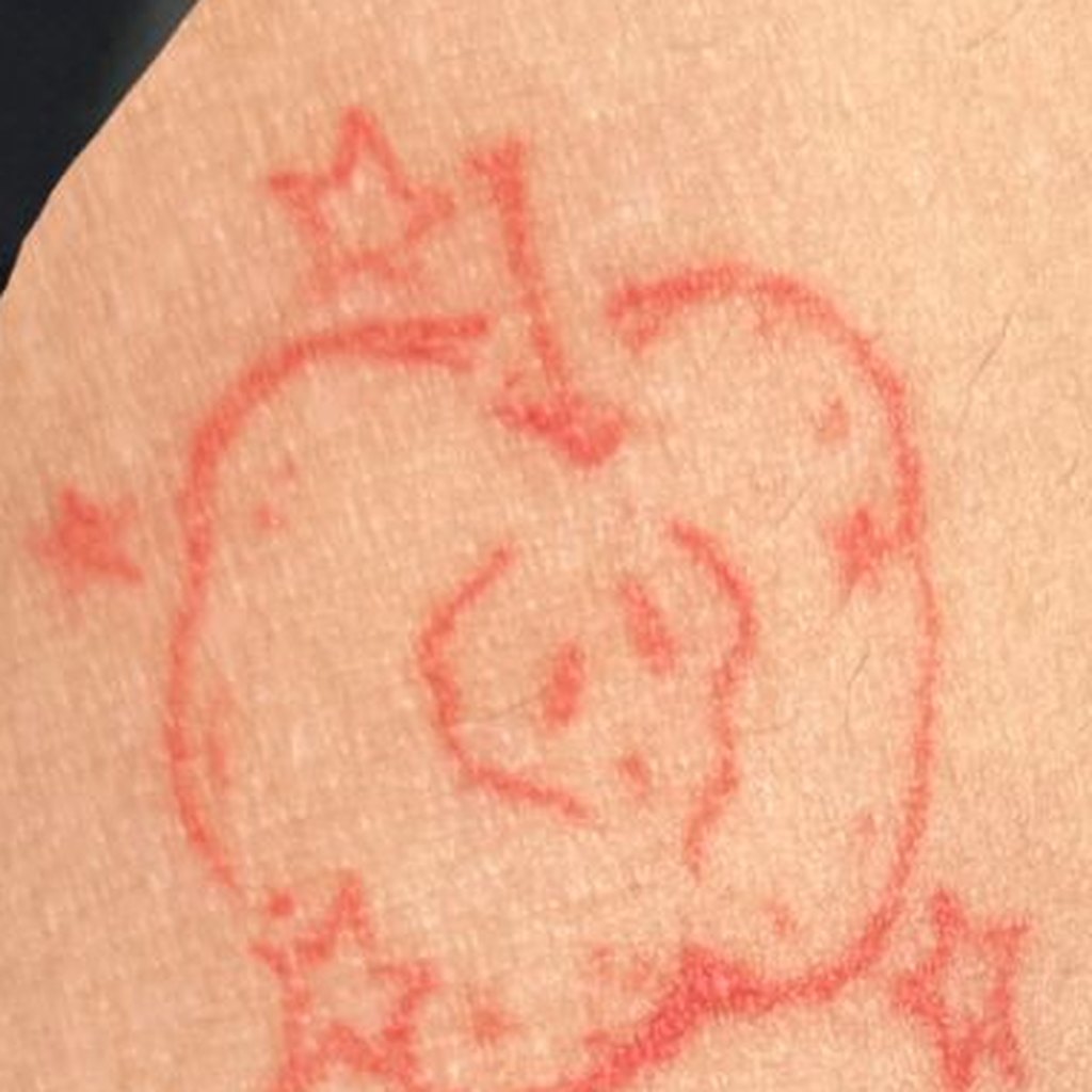 FL-09 sweet heart — healed on skin